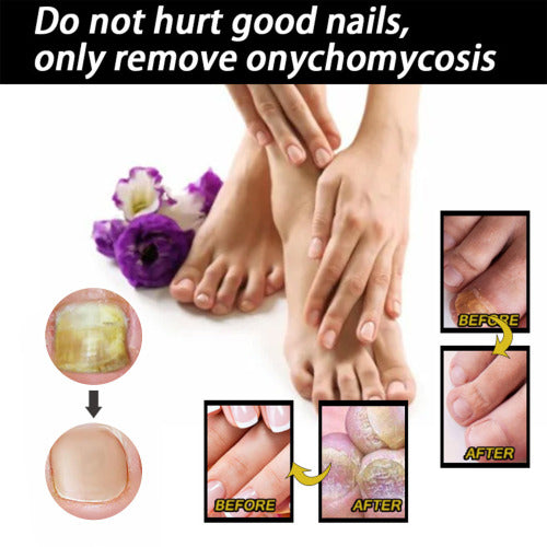 Panthenol Nagelpflege-Flüssigkeit