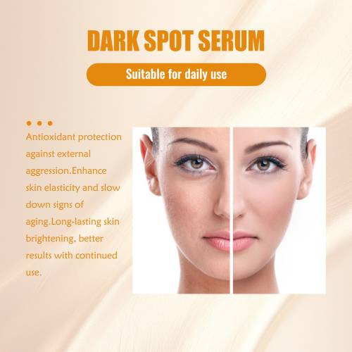 Serum gegen Pigmentflecken mit Kurkuma und Kojisäure