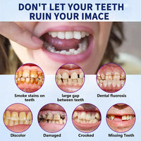 SmileFitPro™ – Lösung der neuen Generation: Flexible Vollprothese