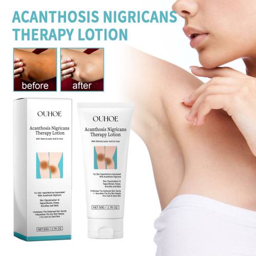 Urea & Milchsäure Körperlotion für raue Stellen