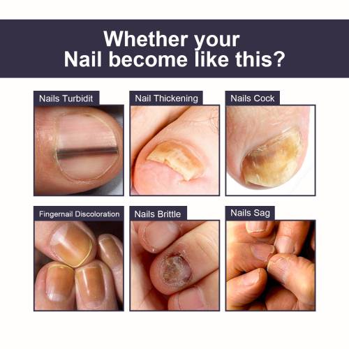 Panthenol Nagelessenz