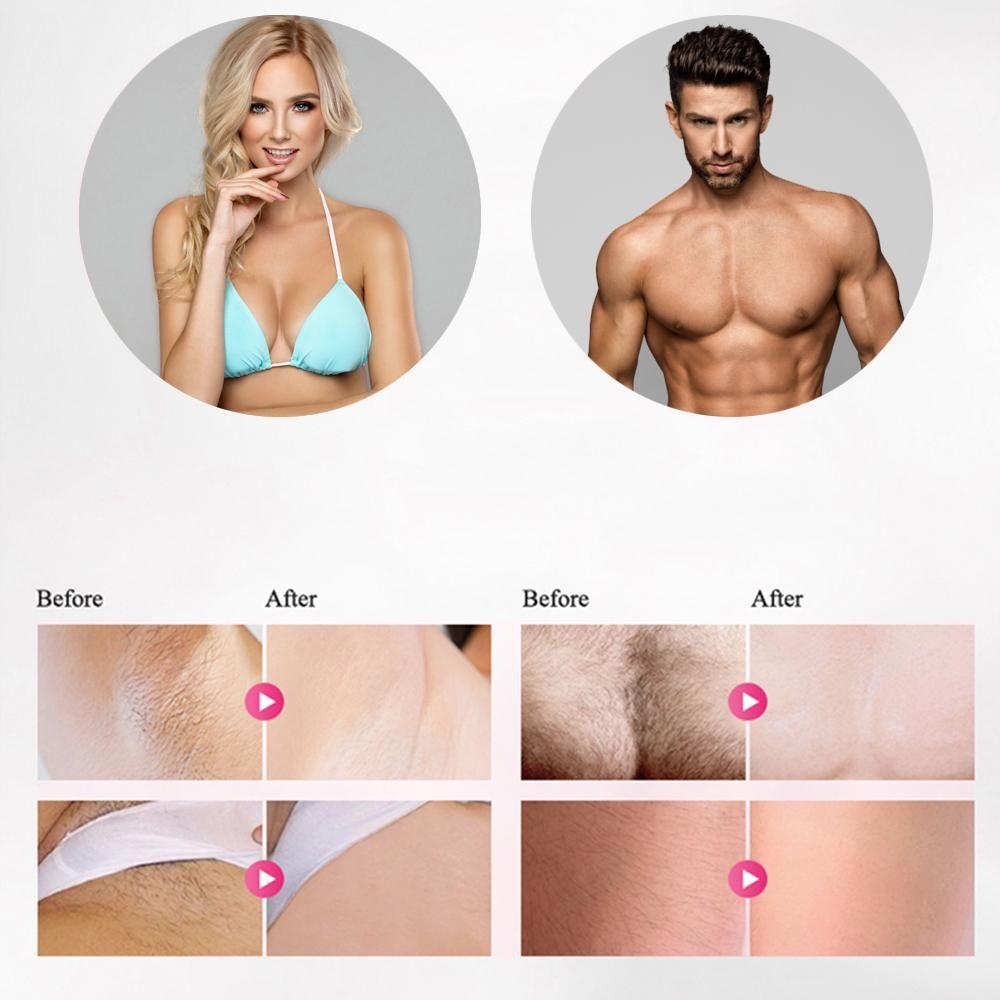 corlado | Professioneller IPL Epilierer Laser-Haarentfernung