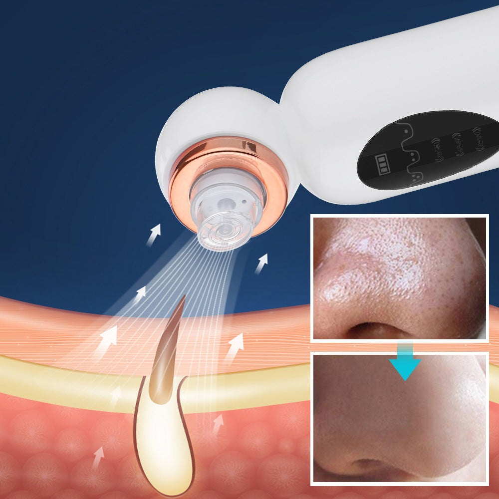 corlado | Hydrodermabrasion Mitesserentferner