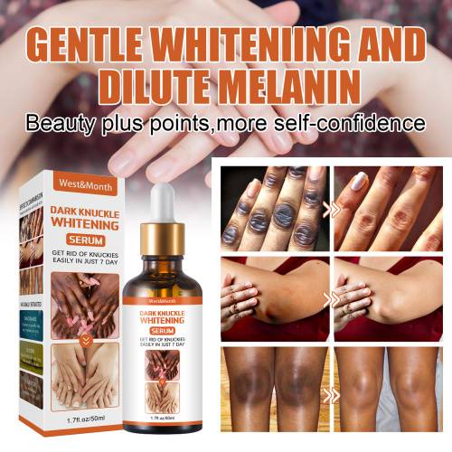 Aufhellendes Serum für Knie, Ellbogen und Knöchel, 50 g