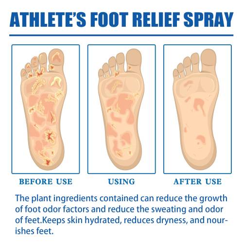 Allantoin Fußpflege-Spray