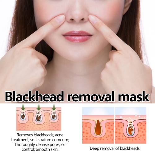 Peel-Off Maske gegen Mitesser