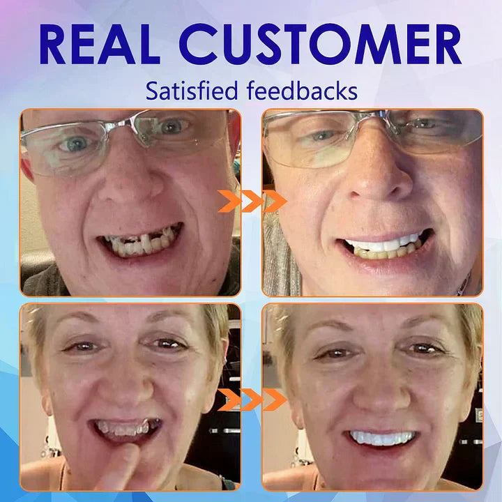 SmileFitPro™ – Lösung der neuen Generation: Flexible Vollprothese