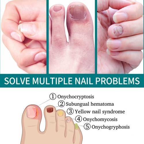 Nagelpflege-Pflaster