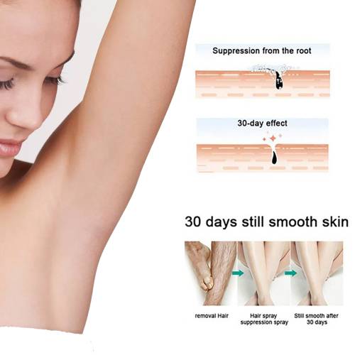Enthaarungsspray für Männer, 30 ml