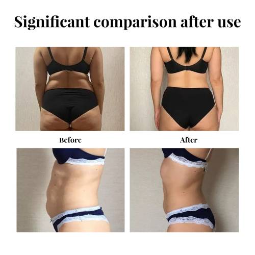Bauch-Hauttape