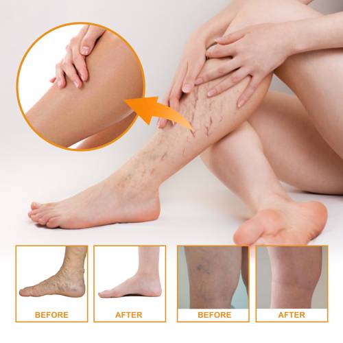 Bein-Massagecreme mit Vitamin K