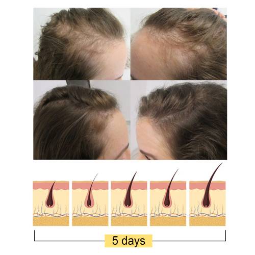Ingwer Reisprotein Shampoo-Bar