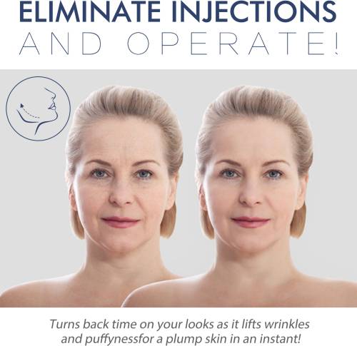 Kollagen Vitamin C Face-Lift-Streifen