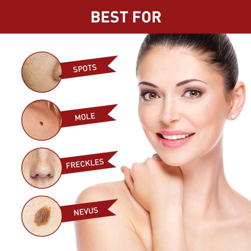 Rosenblatt Hautflüssigkeit