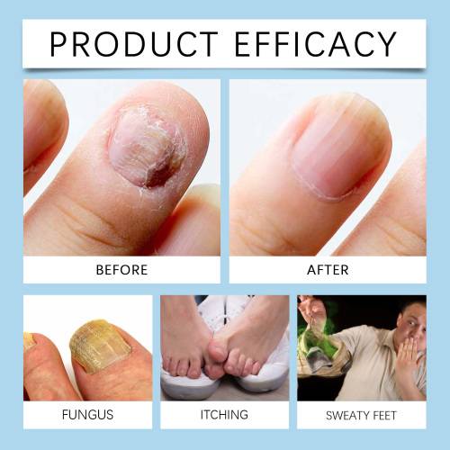 Nagelpflege-Serum für gepflegte Nägel