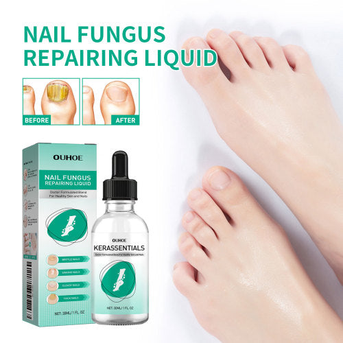 Sanfte Nagelpflege-Lösung