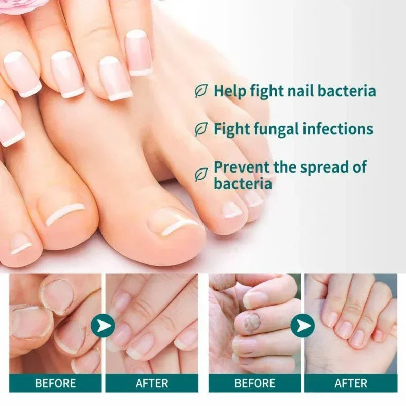 corlado | Nagelpilz Verteidiger Serum