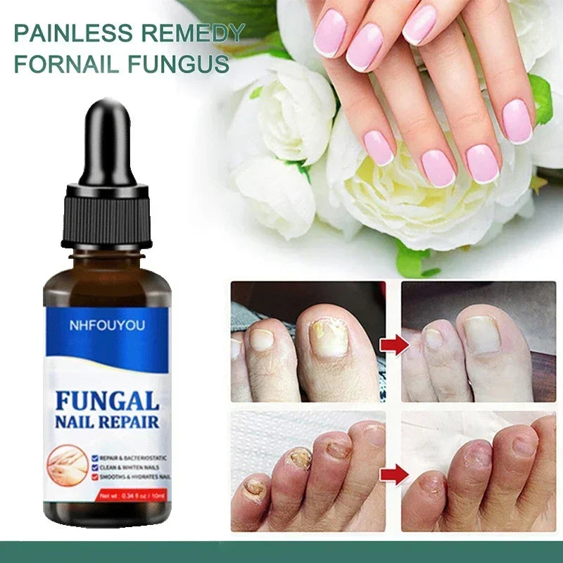 corlado | Nagelpilz Verteidiger Serum