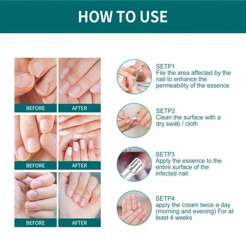 corlado | Nagelpilz Verteidiger Serum