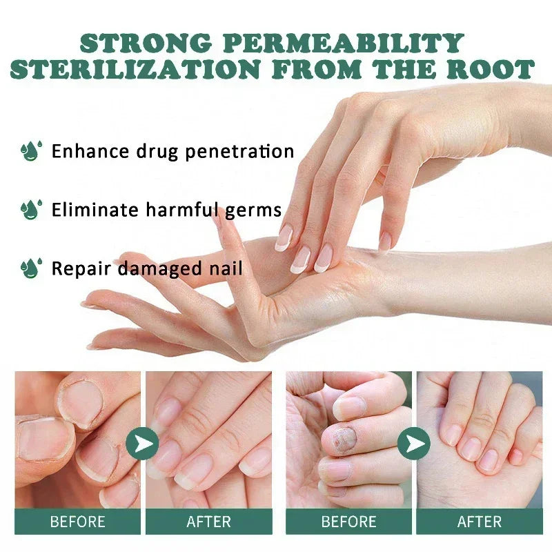 corlado | Nagelpilz Verteidiger Serum