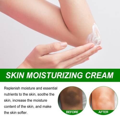 Aufhellende Creme für Ellbogen und Achseln, 50 ml