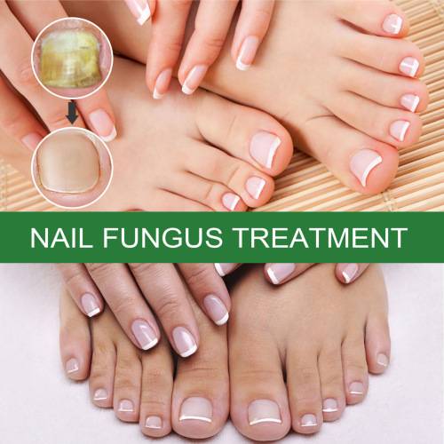 Nagelpflege-Lösung für glänzende, weiche Nägel