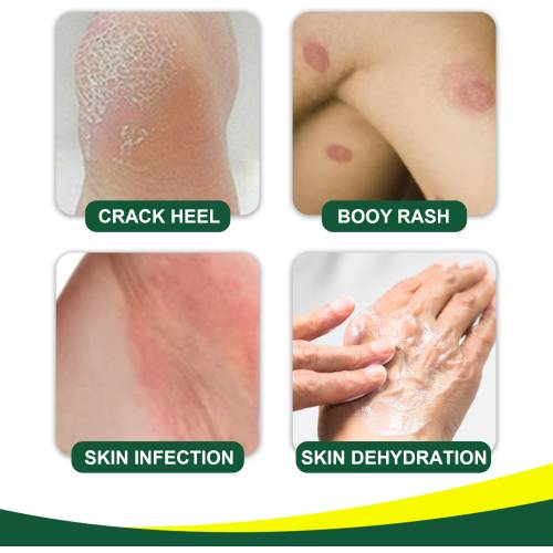 Aloe Honig Avocado Hautcreme