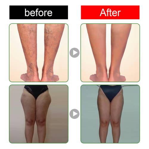 Fußpflaster, 10 Stück