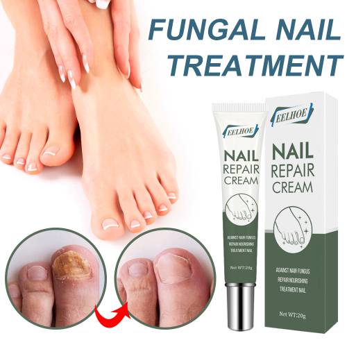 Pflanzliche Nagelcreme