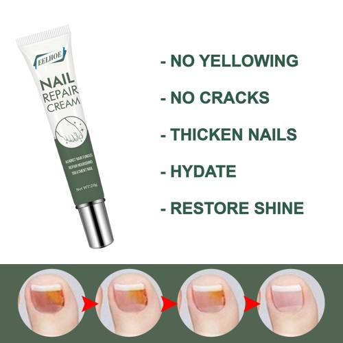 Pflanzliche Nagelcreme