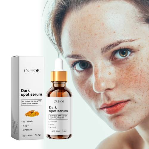 Serum gegen Pigmentflecken mit Kurkuma und Kojisäure