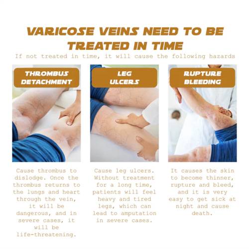 Sheabutter Bein-Massagecreme mit Vitamin K