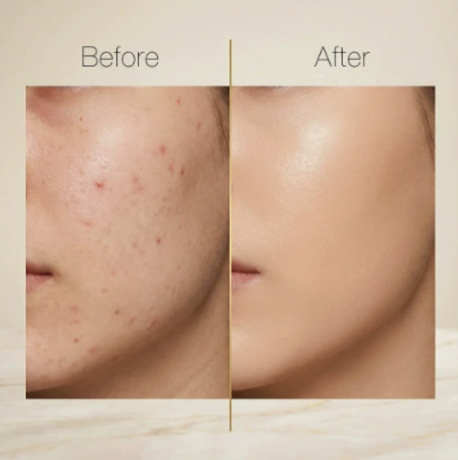 Leichter Concealer mit natürlichem Finish