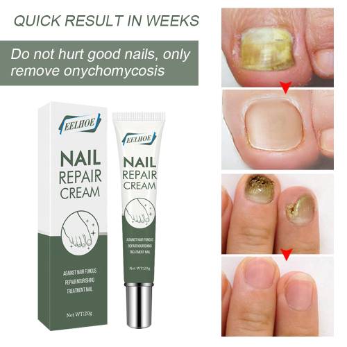 Pflanzliche Nagelcreme