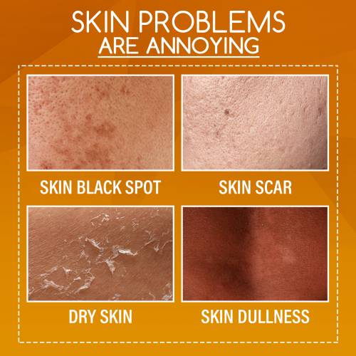 Orangenschalen Körperlotion mit Vitamin C und Centella